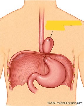 <p>What pathology is shown here?</p>