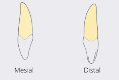 <p>not as deep as mesial </p>