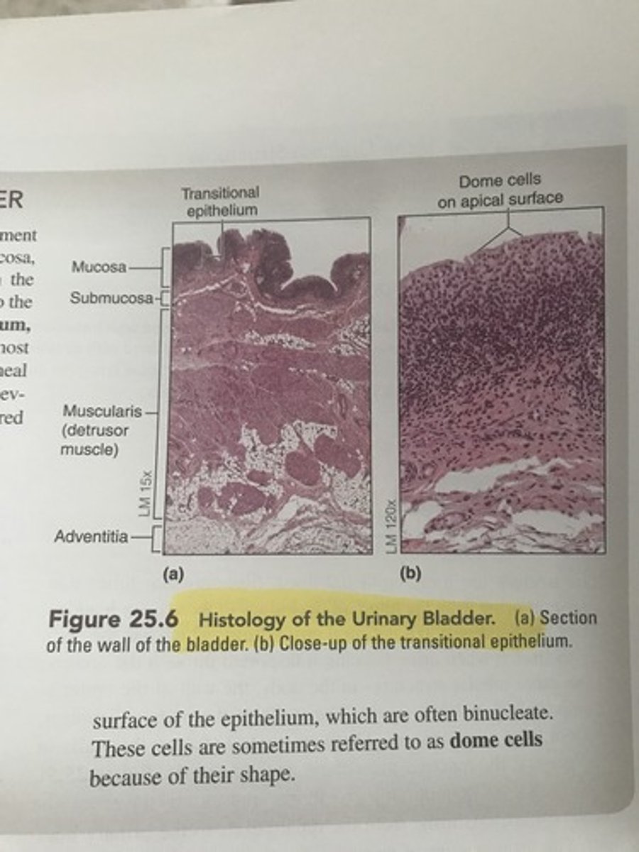 <p>See figure on flashcard!</p>