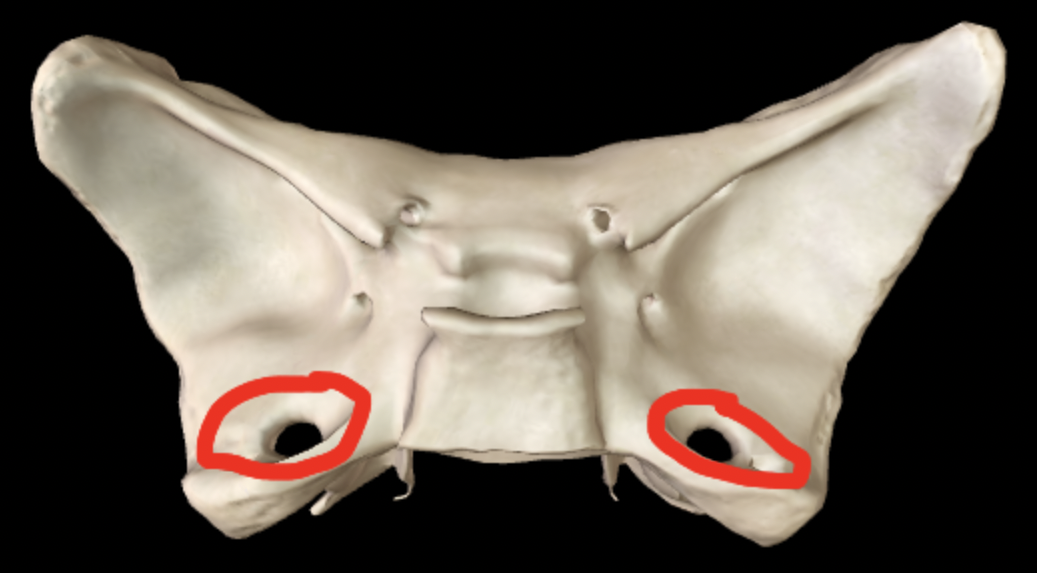 <p>What part of the sphenoid is this?</p>