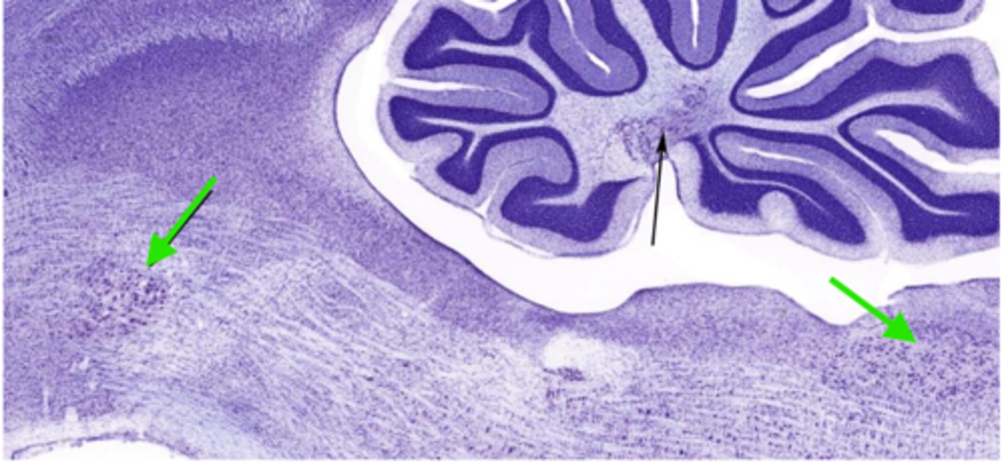 <p>Identify the cluster of neurons at the green arrows</p>
