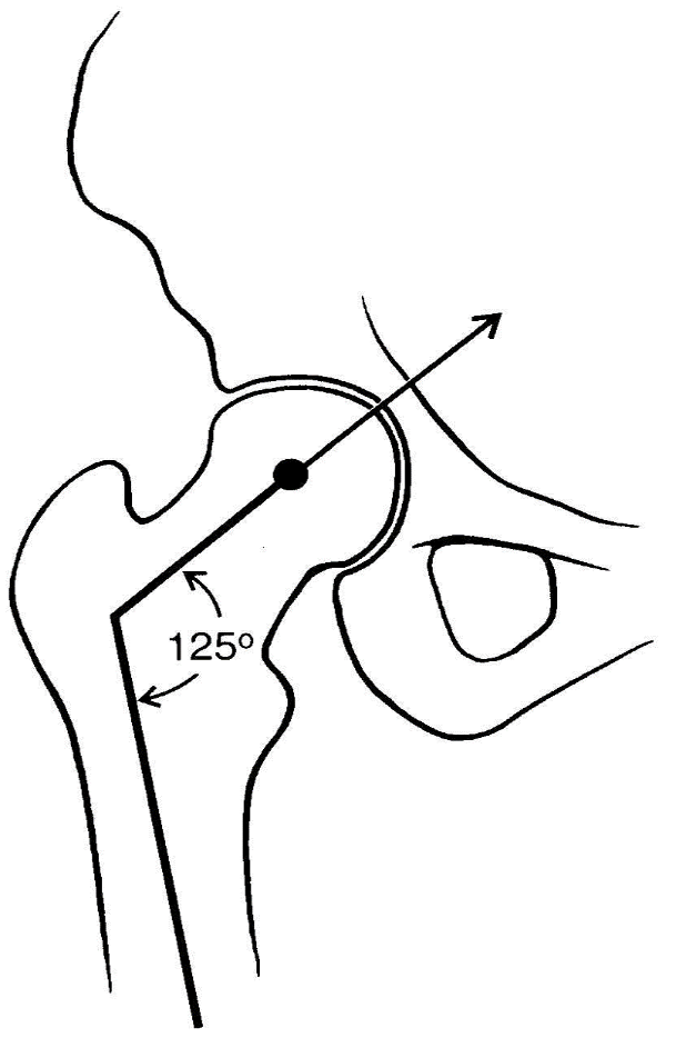 <p>measured in the frontal place and typically ranges from 90-135 degrees with 125 considered average</p>