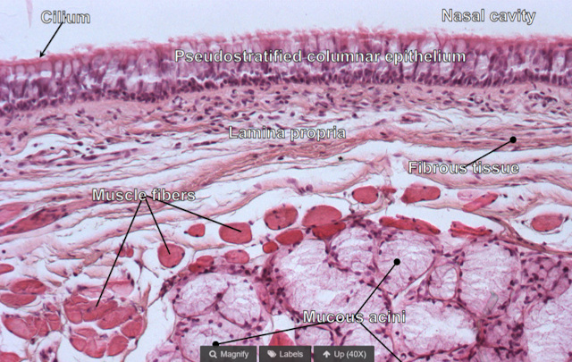 <p>pseudostratified ciliated columnar epithelium with mixed glands</p>