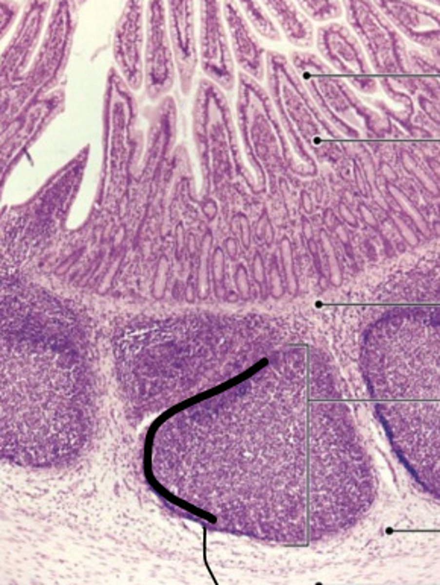 <p>ID the Histology</p>