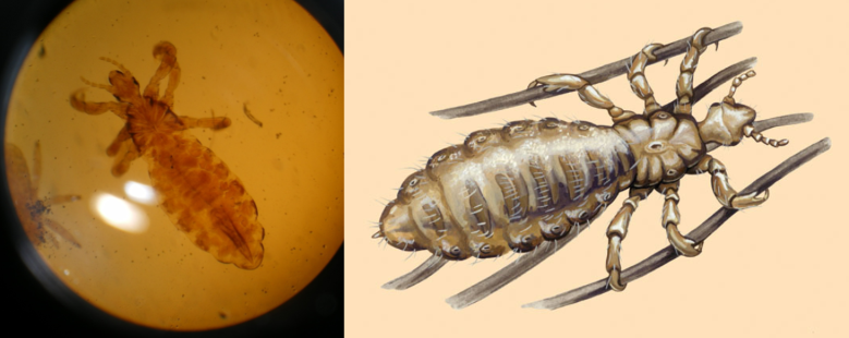 <p>Pediculus humanus/human lice - blood-feeding louse. infests humans. itching and skin irritation. typhus.</p>