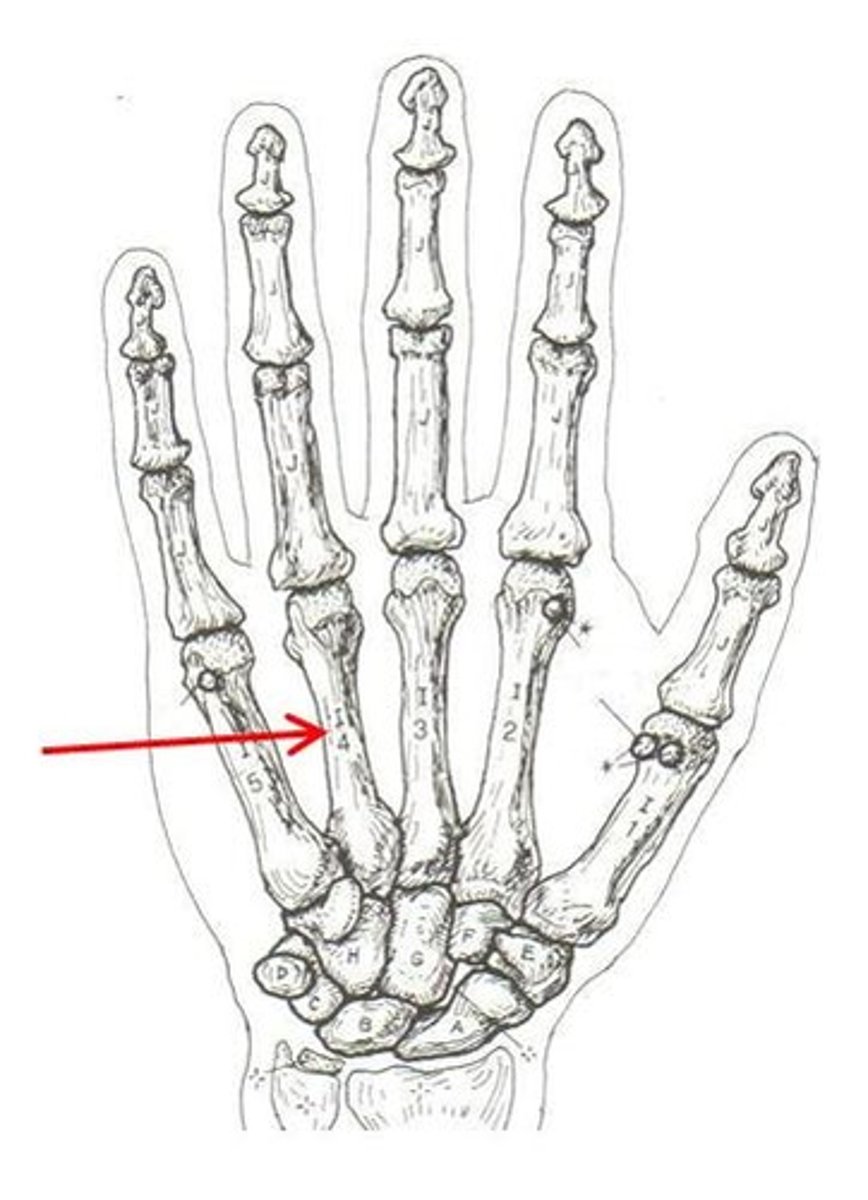 <p>ID bone</p>