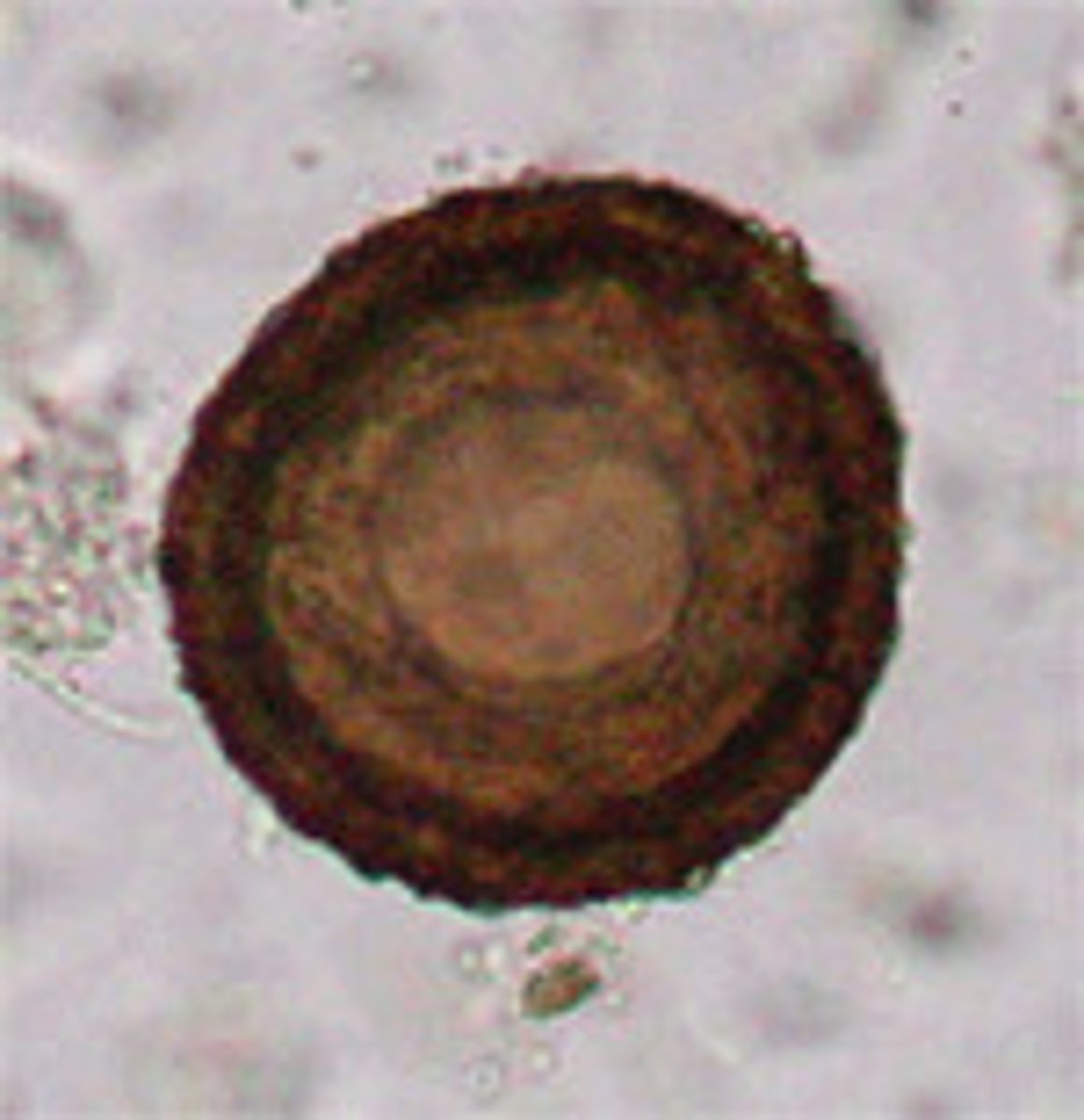 <p>roundworm</p><p>#1 GI parasite in foals</p><p>resp signs, wt loss, diarrhea, impaction</p>