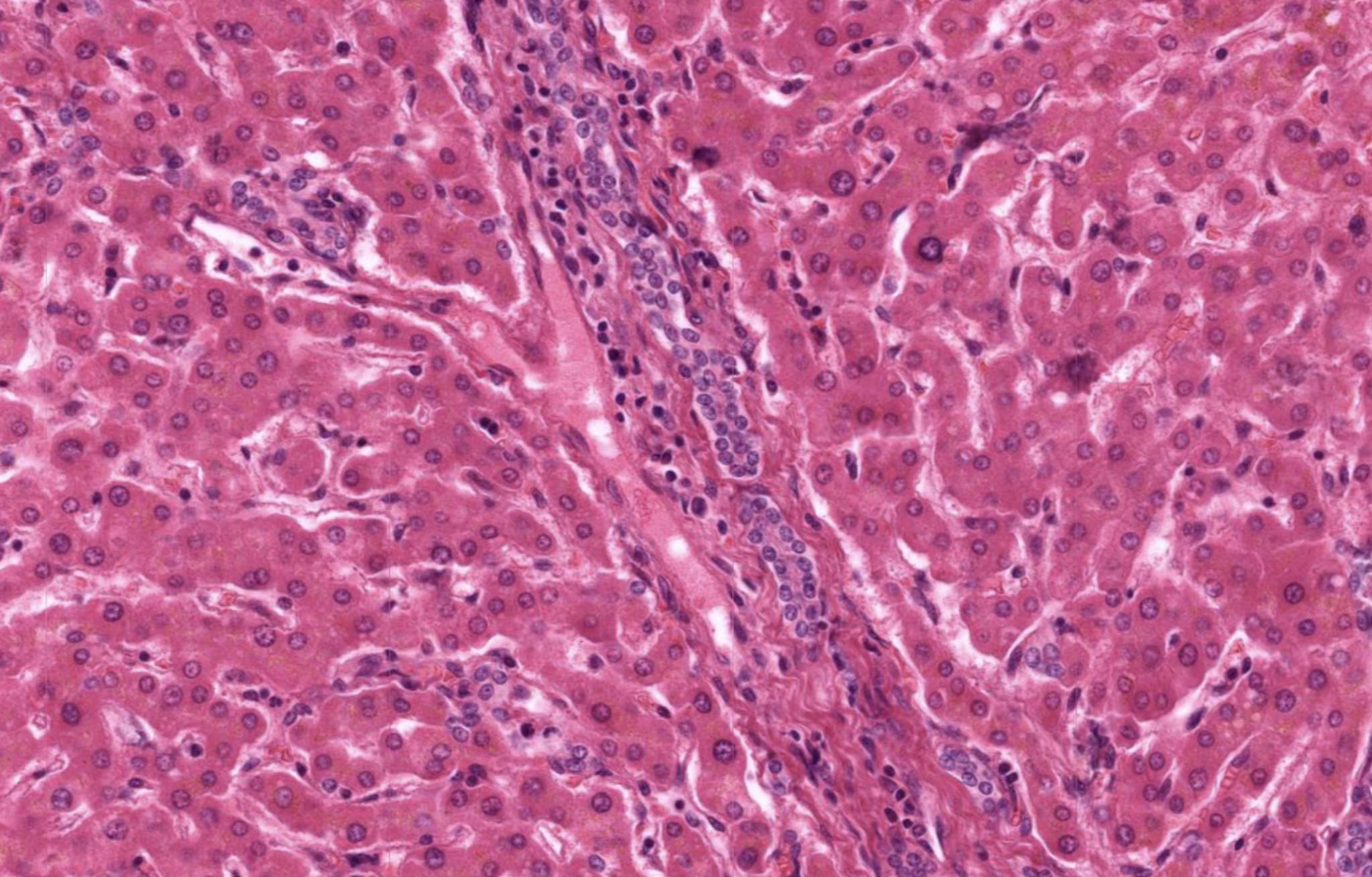 <p>Bile Duct in Liver</p>