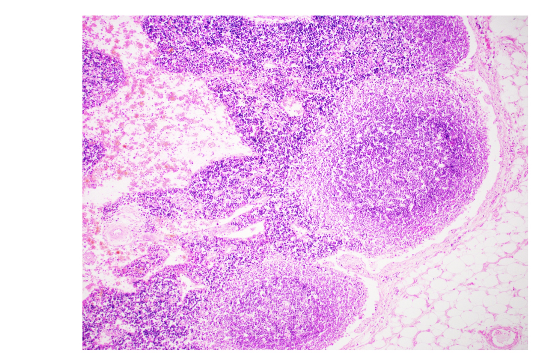 <p>What lymphoid organ is this</p>