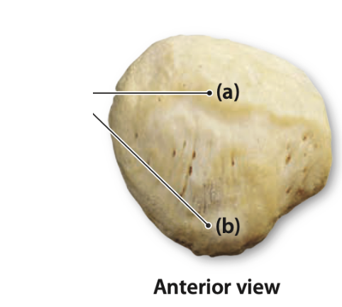 <p>Identify the bone features of the patella</p>