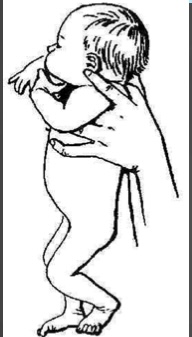 <p>This is an example of what reflex…</p>