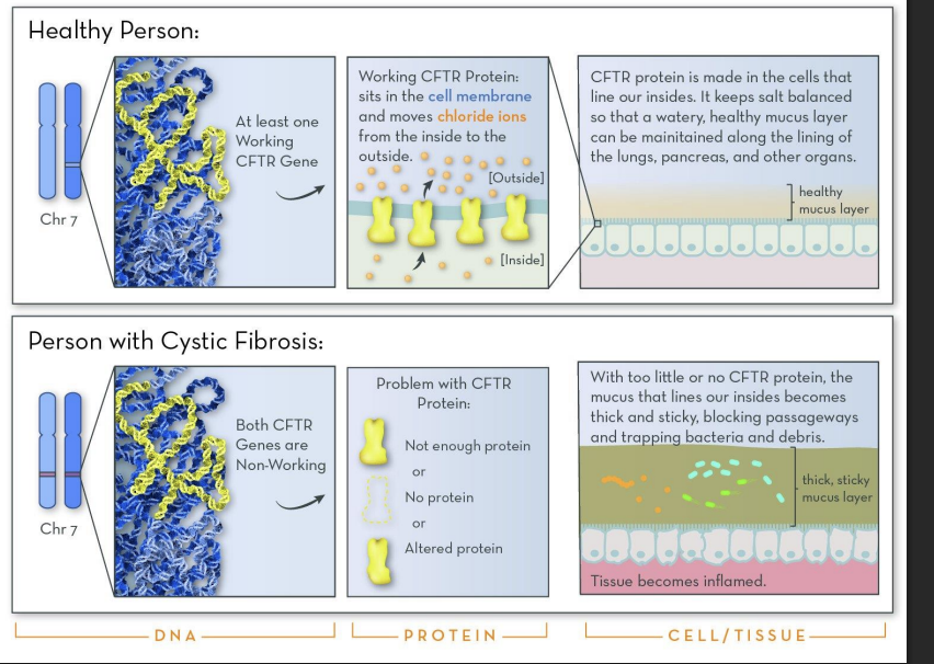 <p>In some genetic diseases, a genetic mutation leads to the expression of a mutant protein (cannot fold properly into native form).</p><p></p><p>This mutant protein is recognized by the quality control pathway in the ER AND IS DESTROYED!</p><p></p><p>Loss of protein and protein’s function in the cell</p>