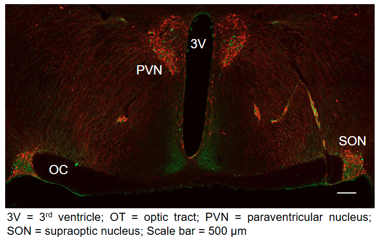<p>PVN: Contains magnocellular and parvocellular neurons </p><p>SON: Only contains magnocellular neurons</p>