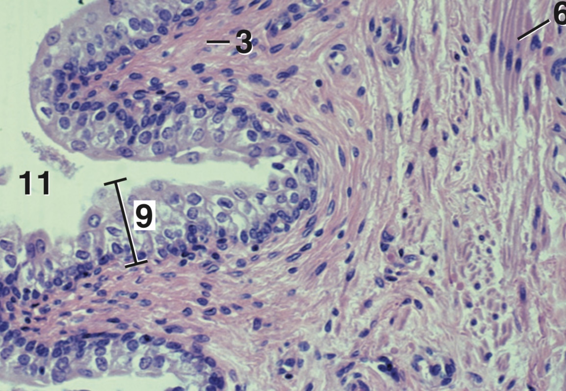 <p>Where can you find this type of epithelium?</p>
