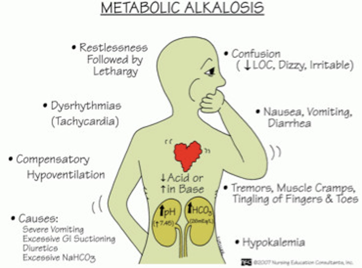 <p>high pH, high HCO3</p><p>caused by Vomiting (lose HCL acid from stomach)</p>