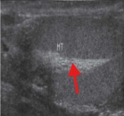 <p>What part of the testicle is seen here?</p>