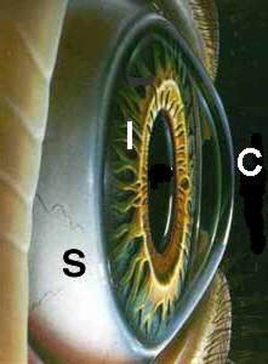 <p>the tough, white outer coat of the eye (S)</p>