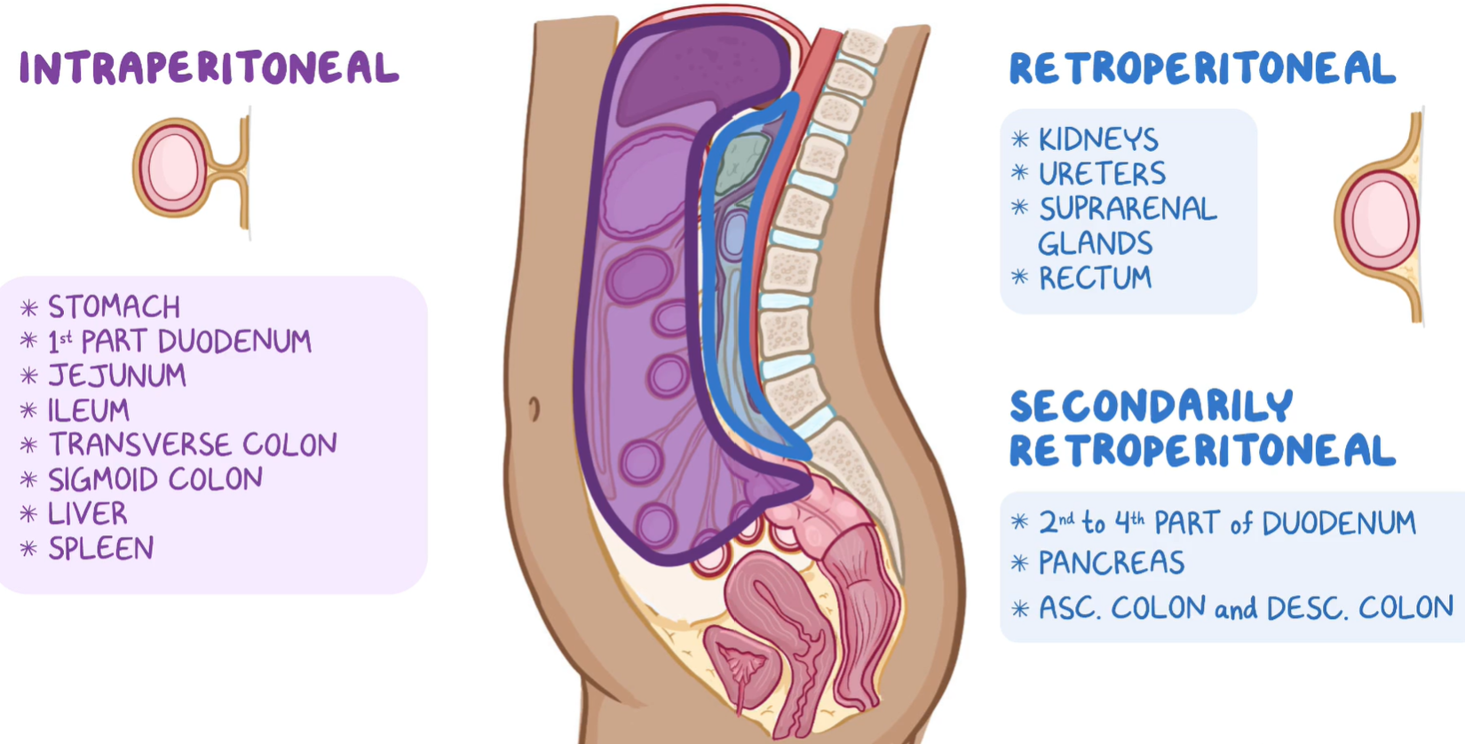<p><strong>Peritoneal Compartments of the Abdominal Cavity</strong></p><p><strong>1. <mark data-color="red" style="background-color: red; color: inherit">Intraperitoneal Space</mark></strong><mark data-color="red" style="background-color: red; color: inherit"> </mark></p><ul><li><p>Organs <strong>suspended by mesenteries</strong>, completely surrounded by visceral peritoneum</p></li><li><p>Examples: stomach, liver, jejunum, ileum, transverse colon, sigmoid colon</p></li></ul><p><strong>2. <mark data-color="red" style="background-color: red; color: inherit">Retroperitoneal Space</mark></strong><mark data-color="red" style="background-color: red; color: inherit"> </mark></p><ul><li><p>Organs lie <strong>behind the peritoneum</strong>, only anterior surface covered by it</p></li><li><p>Examples: kidneys, pancreas (except tail), duodenum (parts 2–4), ascending/descending colon, abdominal aorta</p></li></ul><p><strong>3. <mark data-color="red" style="background-color: red; color: inherit">Subperitoneal (Infraperitoneal) Space</mark></strong><mark data-color="red" style="background-color: red; color: inherit"> </mark></p><ul><li><p>Organs located <strong>beneath the peritoneum</strong>, mostly in the pelvis</p></li><li><p>Examples: urinary bladder, rectum, reproductive organs</p></li></ul><p><span data-name="brain" data-type="emoji">🧠</span> <strong>Additional Compartments &amp; Recesses</strong> </p><ul><li><p><strong><mark data-color="red" style="background-color: red; color: inherit">Greater sac</mark></strong><mark data-color="red" style="background-color: red; color: inherit">: Main peritoneal cavity</mark></p></li><li><p><strong><mark data-color="red" style="background-color: red; color: inherit">Lesser sac (omental bursa)</mark></strong><mark data-color="red" style="background-color: red; color: inherit">: Posterior to stomach and lesser omentum</mark></p></li><li><p><strong><mark data-color="red" style="background-color: red; color: inherit">Omental foramen (of Winslow)</mark></strong><mark data-color="red" style="background-color: red; color: inherit">: Connects greater and lesser sacs</mark></p></li><li><p><strong><mark data-color="red" style="background-color: red; color: inherit">Subphrenic and subhepatic spaces</mark></strong><mark data-color="red" style="background-color: red; color: inherit">: Important for fluid accumulation</mark></p></li><li><p><strong><mark data-color="red" style="background-color: red; color: inherit">Paracolic gutters</mark></strong><mark data-color="red" style="background-color: red; color: inherit">: Pathways for fluid spread along colon sides</mark></p></li></ul><p><span data-name="warning" data-type="emoji">⚠</span> <strong>Clinical Relevance</strong> </p><ul><li><p><strong>Ascites</strong>: fluid accumulation in the peritoneal cavity</p></li><li><p><strong>Peritonitis</strong>: inflammation due to infection or perforation</p></li><li><p><strong>Intraperitoneal injections</strong> use the peritoneal cavity for drug absorption</p></li><li><p><strong>Surgical anatomy</strong> (e.g., laparotomy or laparoscopy) relies on peritoneal reflections and compartments</p></li></ul><p></p>