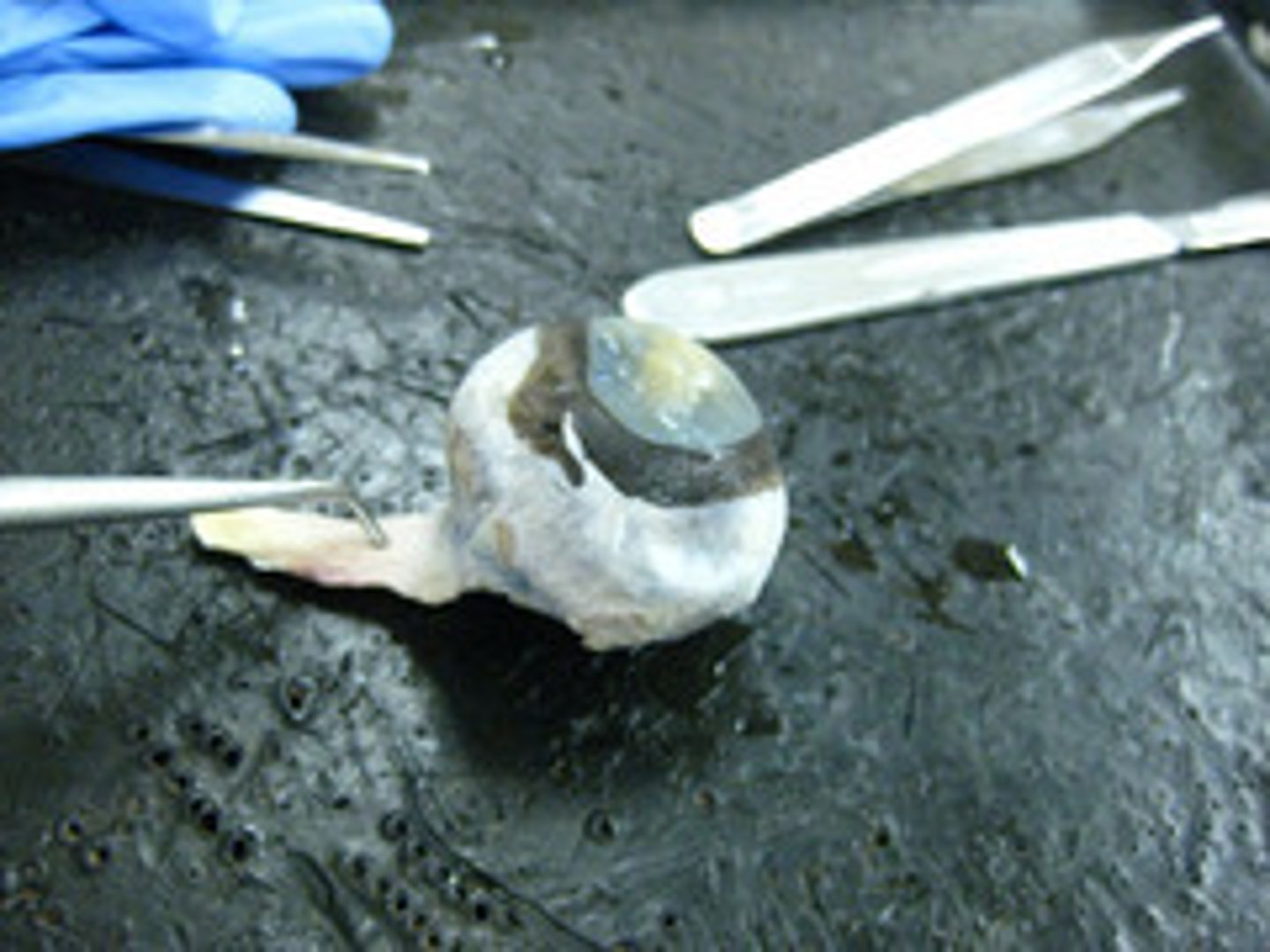 <p>each of the second pair of cranial nerves, transmitting impulses to the brain from the retina at the back of the eye</p>