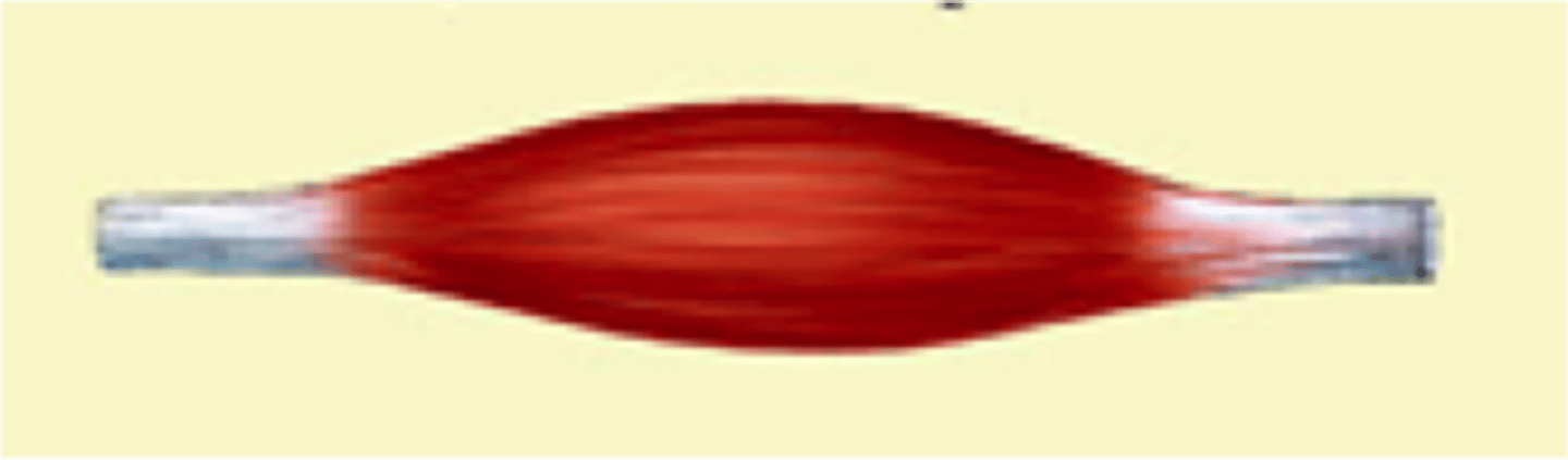 <p>(type of cell) thick in the middle, tapered towards the ends</p>