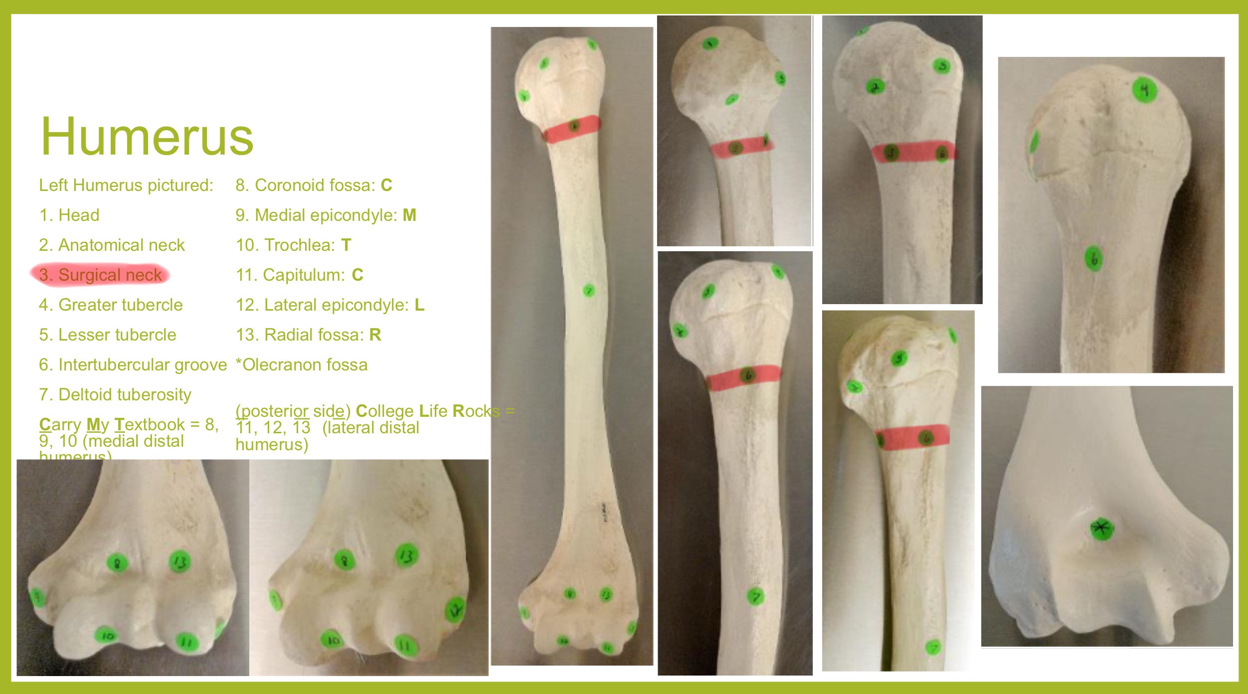 <p>surgical neck of humerus</p>