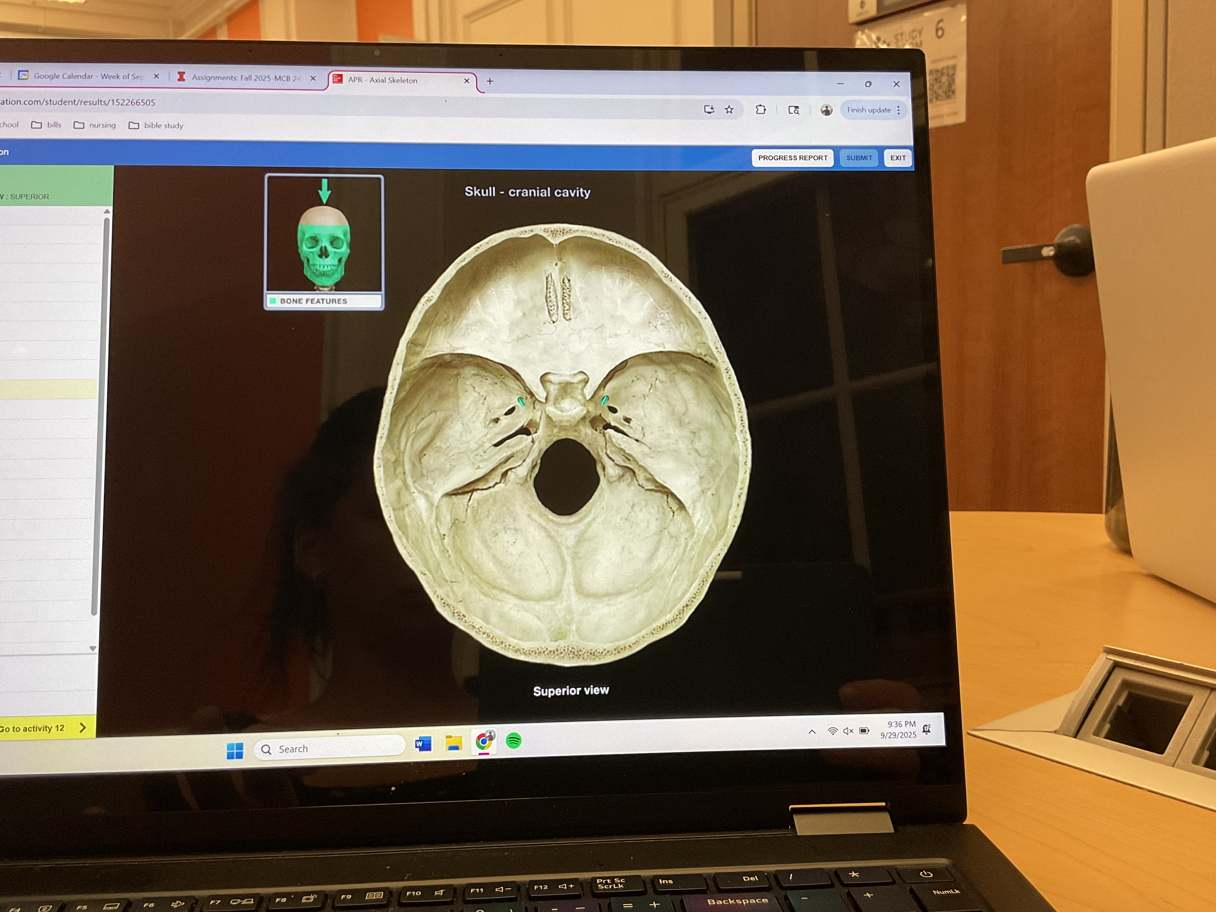 <p>Foramen rotundum</p>