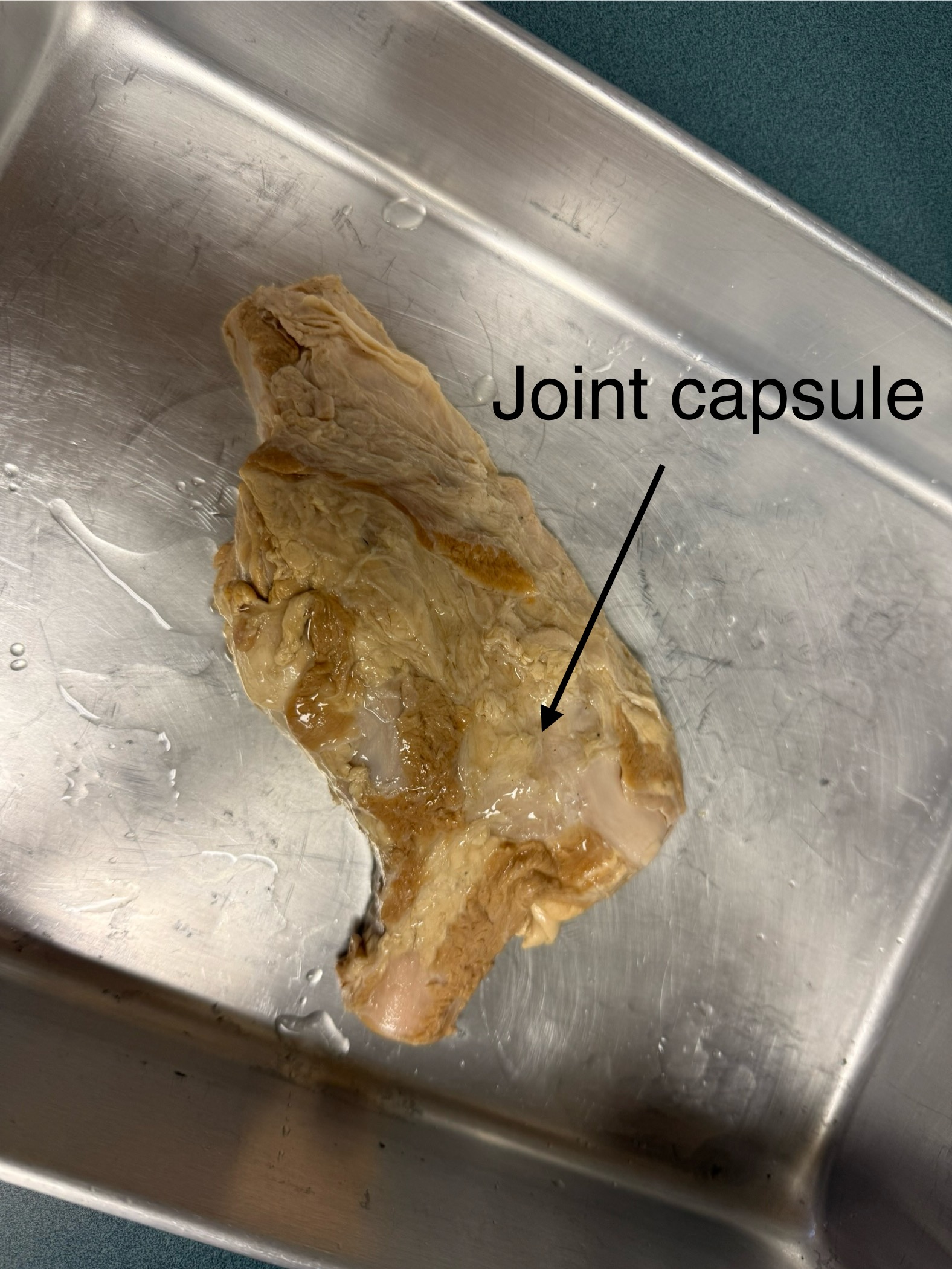 <p>Stifle Joint (femorotibial) </p>
