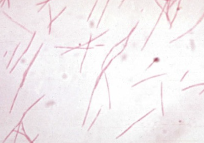 <p>culture looked like “bread crumbs”</p>