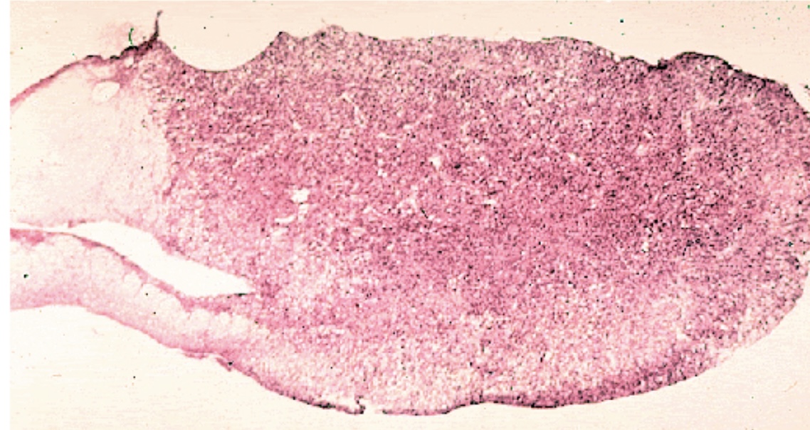 <p>What is the hormone associated with this structure?</p>