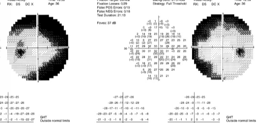 <p>What is this VF plot showing </p>