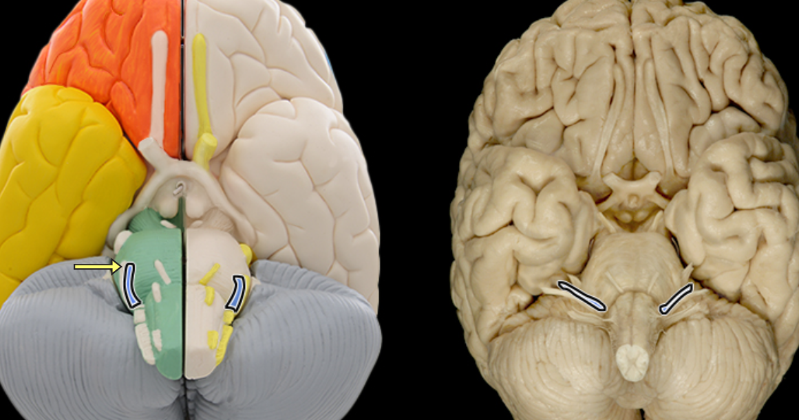 <p>Facial n. CN VII</p>