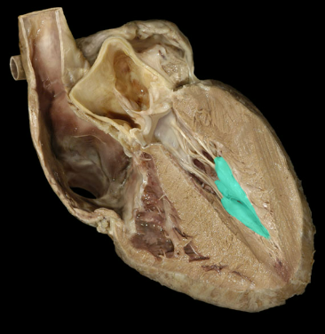 <p>Papillary muscles</p>