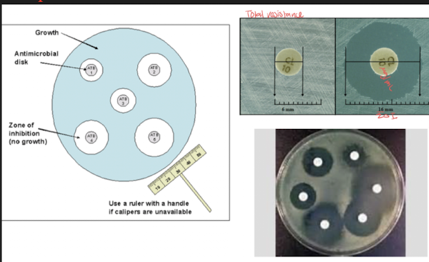 <p><span style="background-color: transparent;">(Kirby Baur susceptibility test)</span></p><ul><li><p><span style="background-color: transparent;">Method of determining bacterial sensitivity to a panel of antimicrobics</span></p></li><li><p><span style="background-color: transparent;">&nbsp;used today and tests several at a time</span></p></li><li><p><span style="background-color: transparent;">&nbsp;results are susceptible, resistant, intermediate</span></p></li></ul><p><span style="background-color: transparent;">Method:</span></p><ol><li><p><span style="background-color: transparent;">Standardized suspension of bacteria is swabbed over surface of a specific type of agar plate in a manner that results in lawn growth</span></p><ol><li><p><span style="background-color: transparent;">&nbsp;we want bacteria all over surface</span></p></li><li><p><span style="background-color: transparent;">&nbsp;three-way streak to prevent isolated colony growth</span></p></li><li><p><span style="background-color: transparent;">&nbsp;known approximate number of bacteria/ density across all assay&nbsp;</span></p></li></ol></li><li><p><span style="background-color: transparent;">Paper discs containing single concentrations of antibacterial agents are placed on inoculated surface</span></p><ol><li><p><span style="background-color: transparent;">&nbsp;Filter disk:&nbsp; saturated with specific concentration of antimicrobial agent</span></p><ol><li><p><span style="background-color: transparent;">conc=MIC which allows to see which antimic works best</span></p></li></ol></li><li><p><span style="background-color: transparent;">Test multiple antibiotics on same disk</span></p></li><li><p><span style="background-color: transparent;">Antibiotic diffuse into&nbsp; agar in all directions evenly while bacteria is growing during incubation</span></p></li></ol></li><li><p><span style="background-color: transparent;">&nbsp;plates are incubated</span></p></li><li><p><span style="background-color: transparent;">&nbsp;diameters and millimeters of zones of inhibition of bacteria growth are measured</span></p><ol><li><p><span style="background-color: transparent;">&nbsp;bacteria grow until reach susceptible antibi</span></p></li></ol></li></ol><p><span style="background-color: transparent;">&nbsp;personalized med: specific to particular patient - E coli is from patient sample for example&nbsp;</span></p><p><span style="background-color: transparent;">National Committee on Clinical Laboratory services:&nbsp;&nbsp;</span></p><ul><li><p><span style="background-color: transparent;">determine when an organism becomes resistant due to changes in concentration of MIC;&nbsp;</span></p></li><li><p><span style="background-color: transparent;">they constantly monitor and set interpretive standards&nbsp;</span></p></li></ul><p><span style="background-color: transparent;">Results:&nbsp;</span></p><ul><li><p><span style="background-color: transparent;">Diameters of zones of inhibition of bacterial growth are measured and recorded as S, R, I</span></p><ul><li><p><span style="background-color: transparent;">S:&nbsp; sensitive, susceptible: microbial growth is inhibited at concentration safely attainable in the patient</span></p></li><li><p><span style="background-color: transparent;">R:&nbsp; resistant: microbial growth is present at concentrations above what is safely attainable in the patient</span></p></li><li><p><span style="background-color: transparent;">I:&nbsp; intermediate: microbial growth is present at concentrations above susceptible breakpoint but may be effective under some conditions</span></p></li></ul></li></ul><p><span style="background-color: transparent;">Chart to det. S/R/I results</span></p>