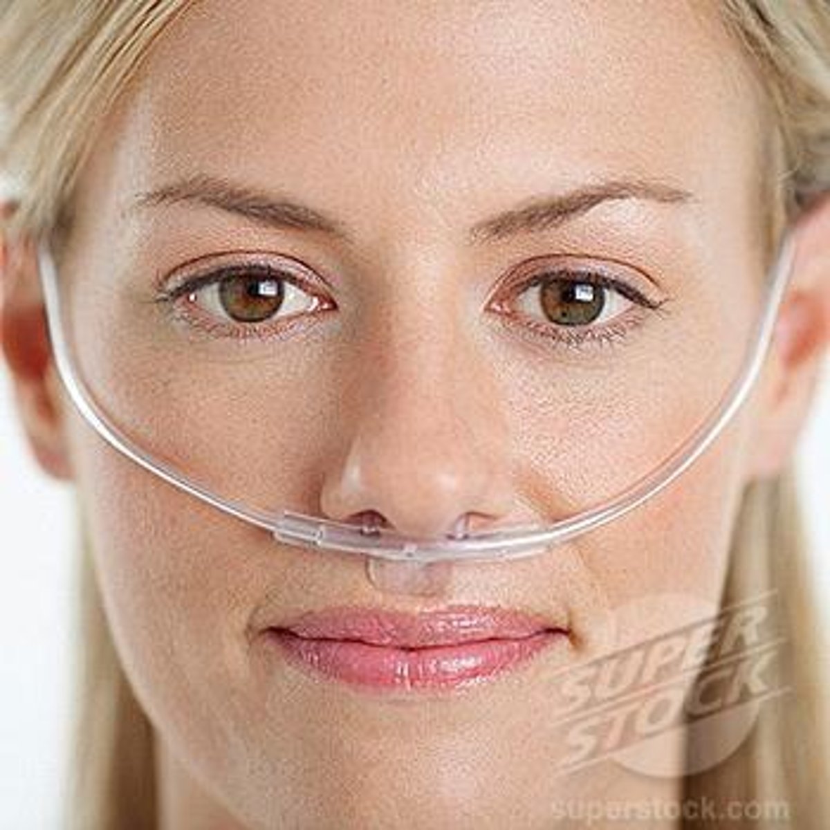 <p>An oxygen-delivery device in which oxygen flows through two small, tubelike prongs that fit into the patient's nostrils; delivers 24% to 44% supplemental oxygen, depending on the flow rate.</p>
