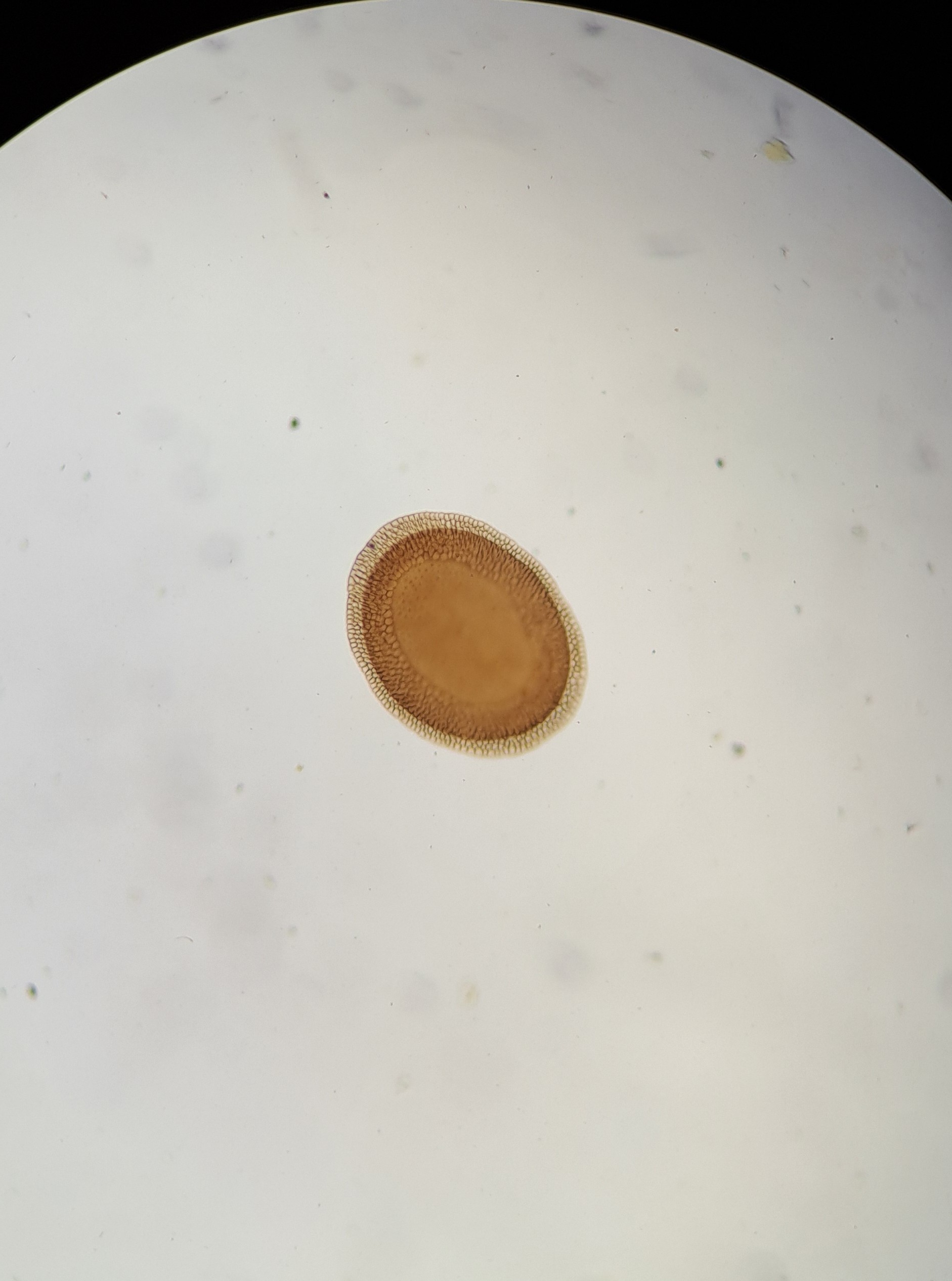 <p><em><span>Plumantella fungosa</span></em><span> - </span><u><span>chvostnatka houbovitá</span></u></p><ul><li><p>statoblasty, preparáty v lihu</p></li></ul><p></p>