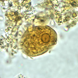 <p>Identify this 17 µm ameoba.<br><br>Dientamoeba fragilis</p><p>Endolimax nana</p><p>Entamoeba coli</p><p>Entamoeba hartmanni</p><p>Entamoeba histolytica</p>