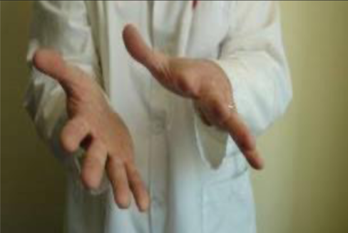 <p>Identify the Cranial Strain Pattern:</p>
