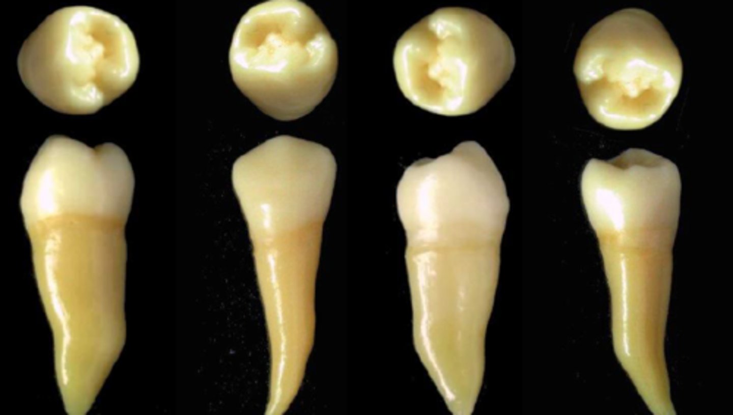 <p>what tooth is this &amp; why?</p>