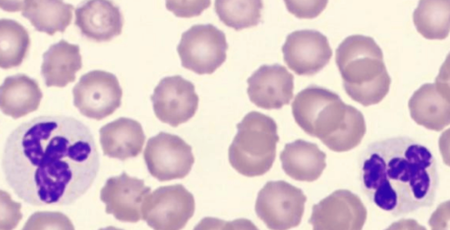 <p>what leukocyte is this?</p>