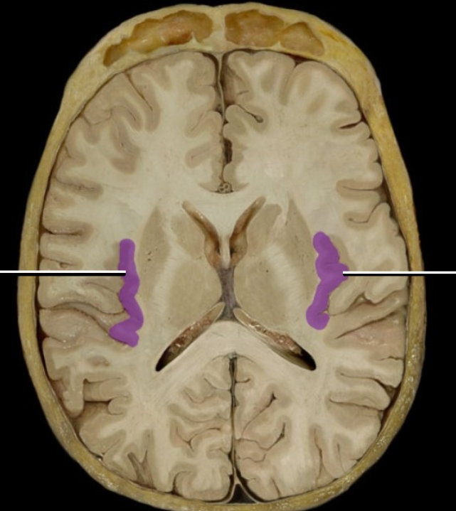 <p><br><span><span>Insula</span></span></p>