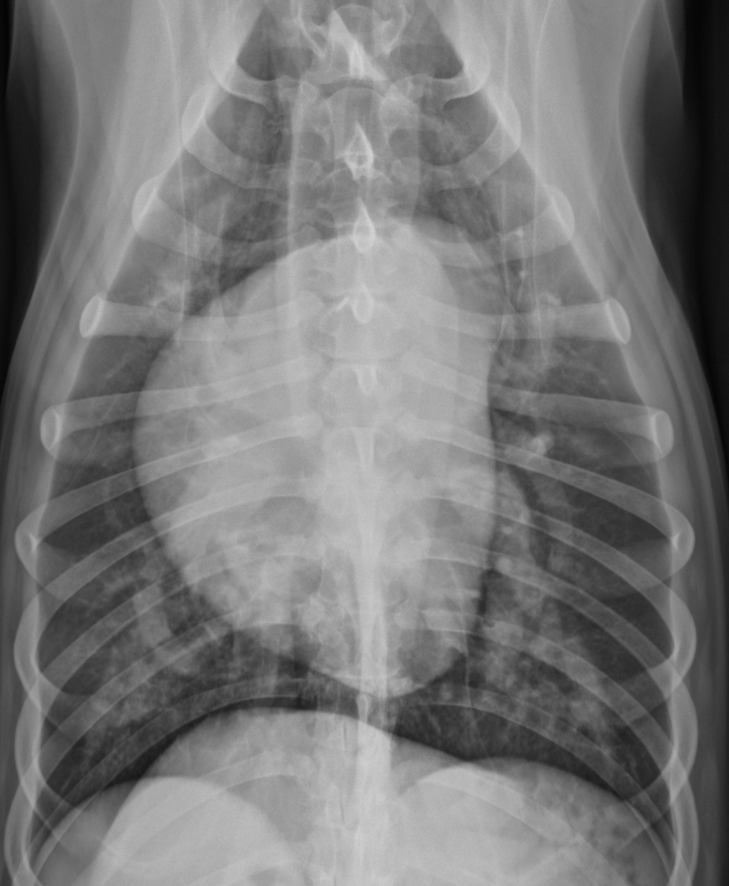 <p>What part of the heart is enlarged </p>