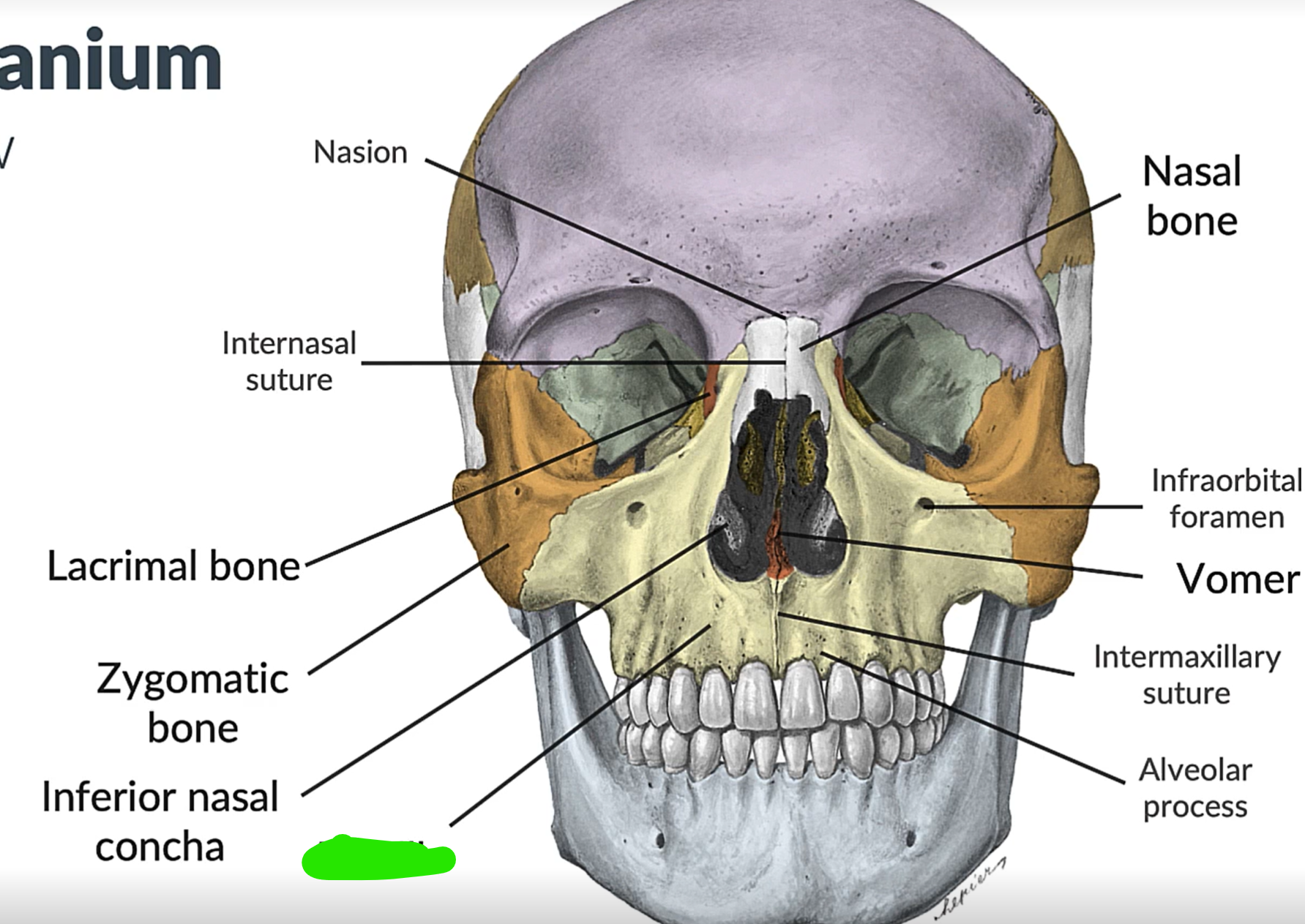 term image