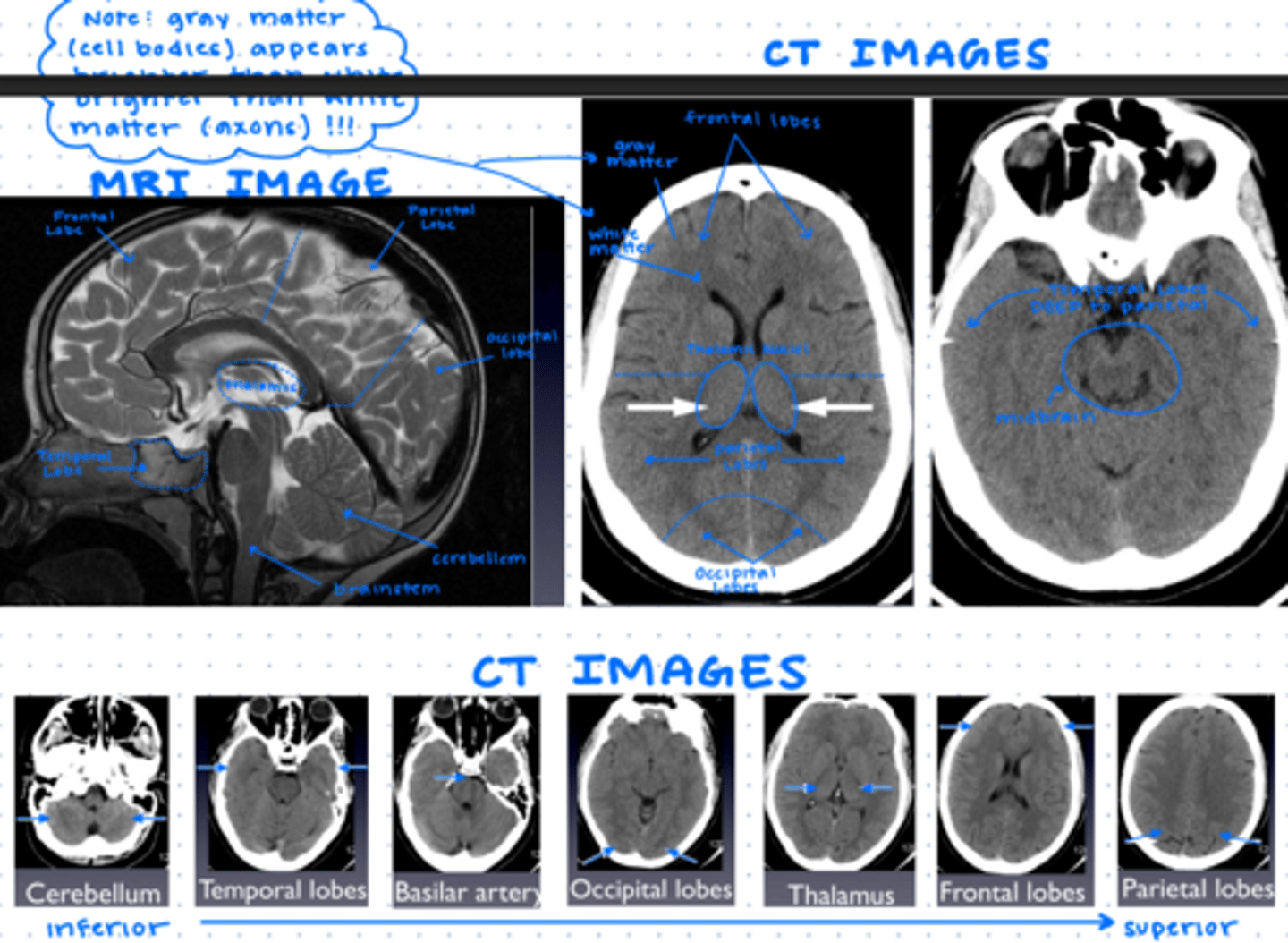 knowt flashcard image