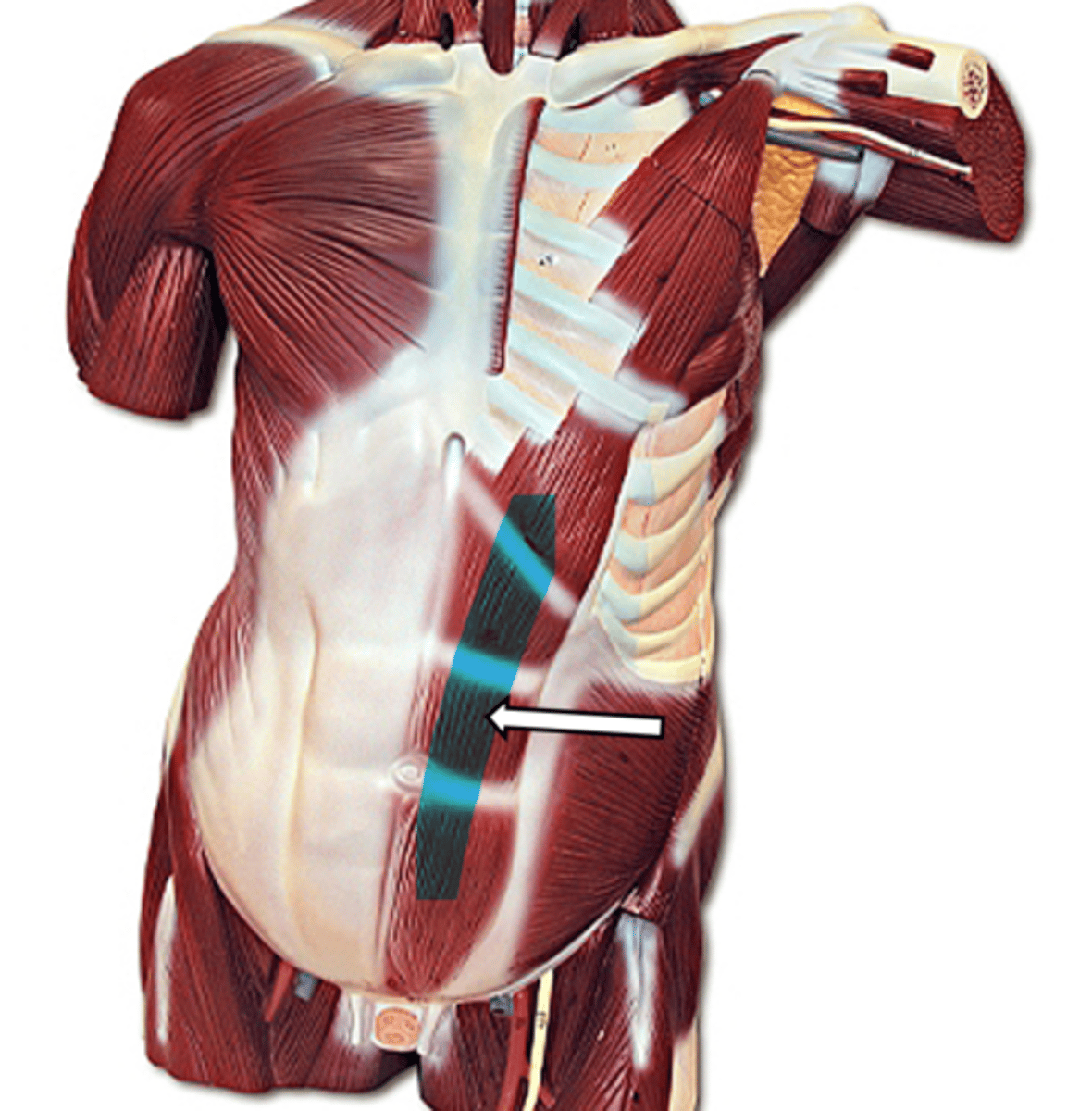 <p>name the muscle</p>