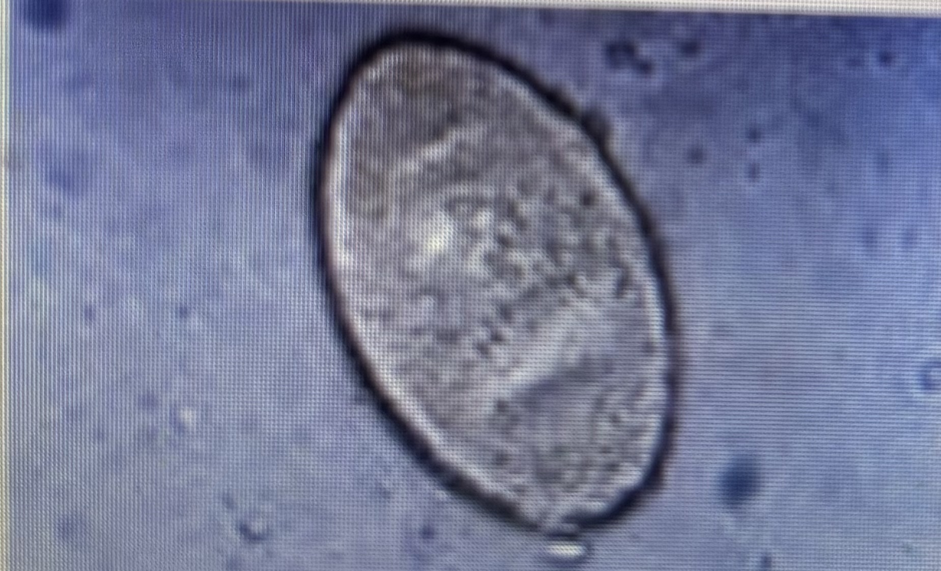 <p>Host species ruminants</p><p>Size 130-150 um x 63-90 um </p><p>Liver fluke </p>