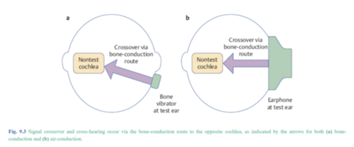<p>To prevent participation from the non-test ear.</p>