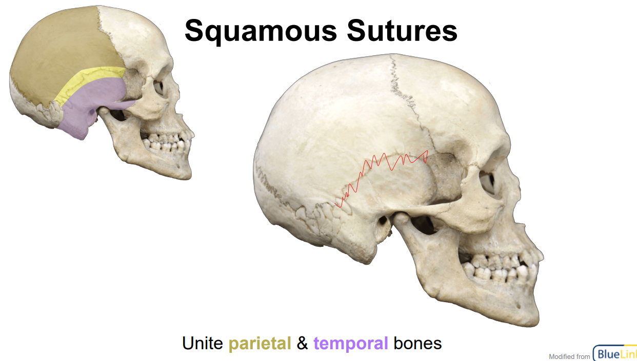 <p>Unite <span style="color: yellow">parietal</span> and <span style="color: purple">temporal</span> bones</p>