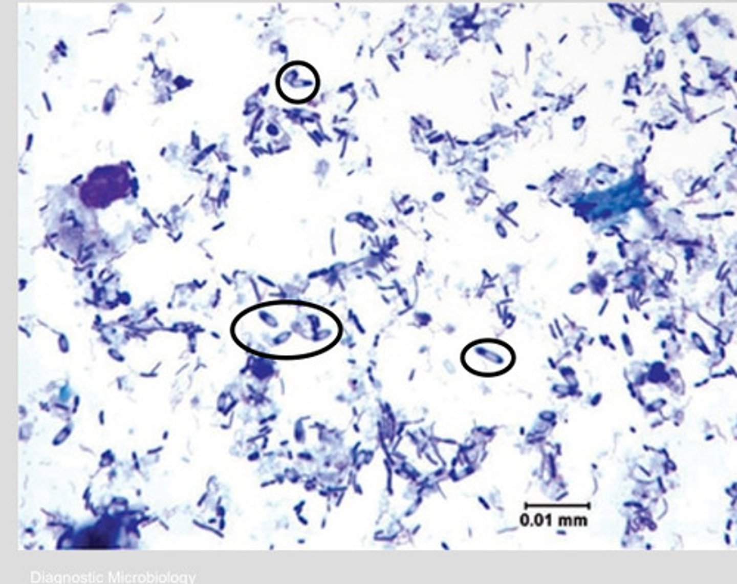 <p>Naturally occurring GI bacteria with endospores</p><p>-can cause diarrhea in excess</p>