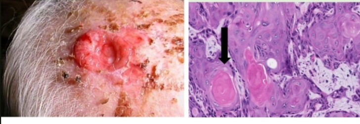 <p>identify then describe microscopically and macroscopically</p><p>+Arrow refer to?</p>