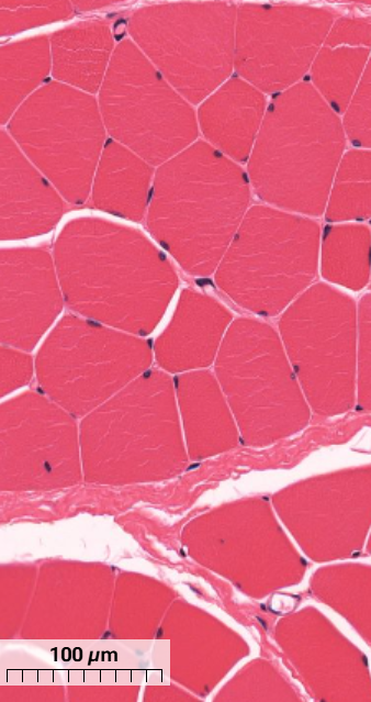 <p>What thick tissue layer is seen in the skeletal muscle?</p>